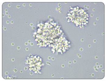 Activated Morphology of Human T Cells Stimulated With ImmunoCult™ Human CD3/CD28 T Cell Activator