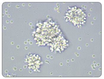 Activated Morphology of Human T Cells Stimulated With ImmunoCult™ Human CD3/CD28 T Cell Activator