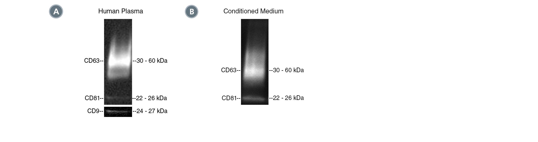 Postive isolation of EVs with the CD63 tetraspanin marker from human plasma and MSC-conditioned medium.