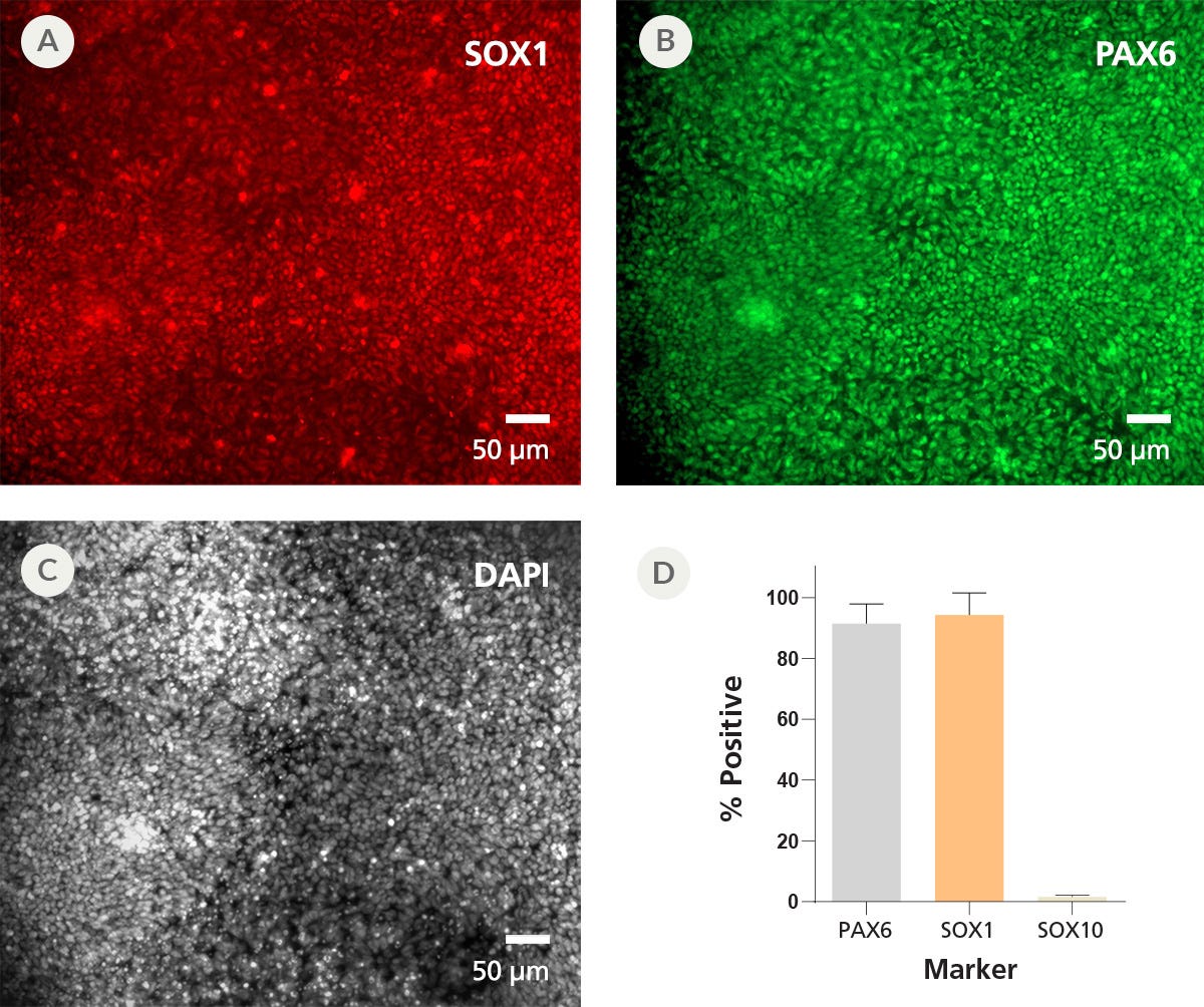 Immunofluorescent images of 2 neural progenitor markers and a nuclear stain along with their quantification