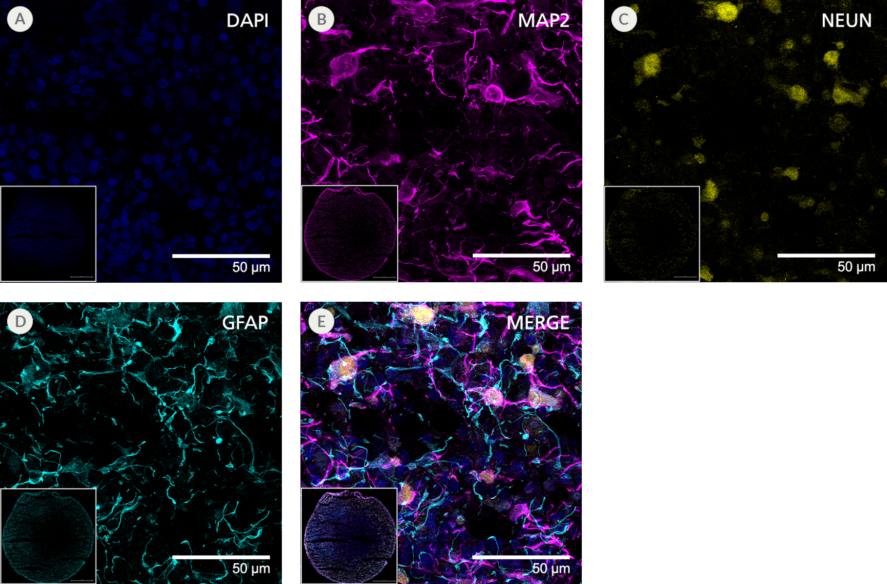 Immunofluorescent images of 2 neuronal markers, an astrocyte marker, and a nuclear stain in a dorsal forebrain organoid at low and high magnification