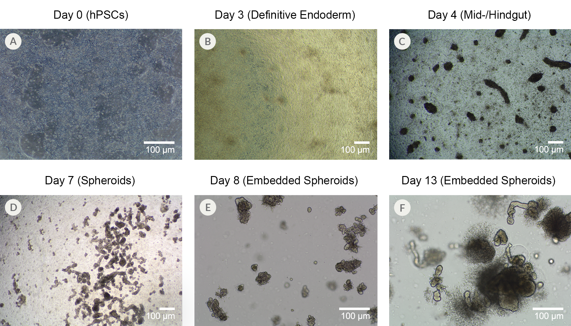 13-day time course brightfield images of iPSCs differentiating into intestinal organoids, changing morphology, and detaching from the culture plate