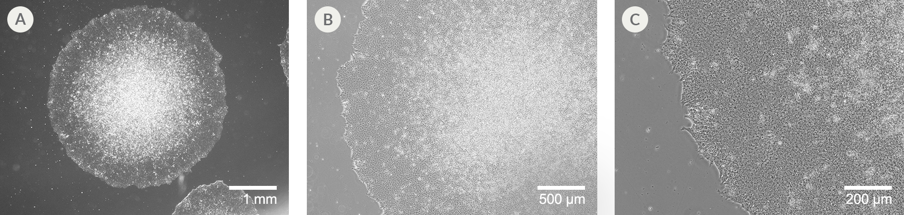 Brightfield images of increasing magnification show typical healthy iPSC morphology