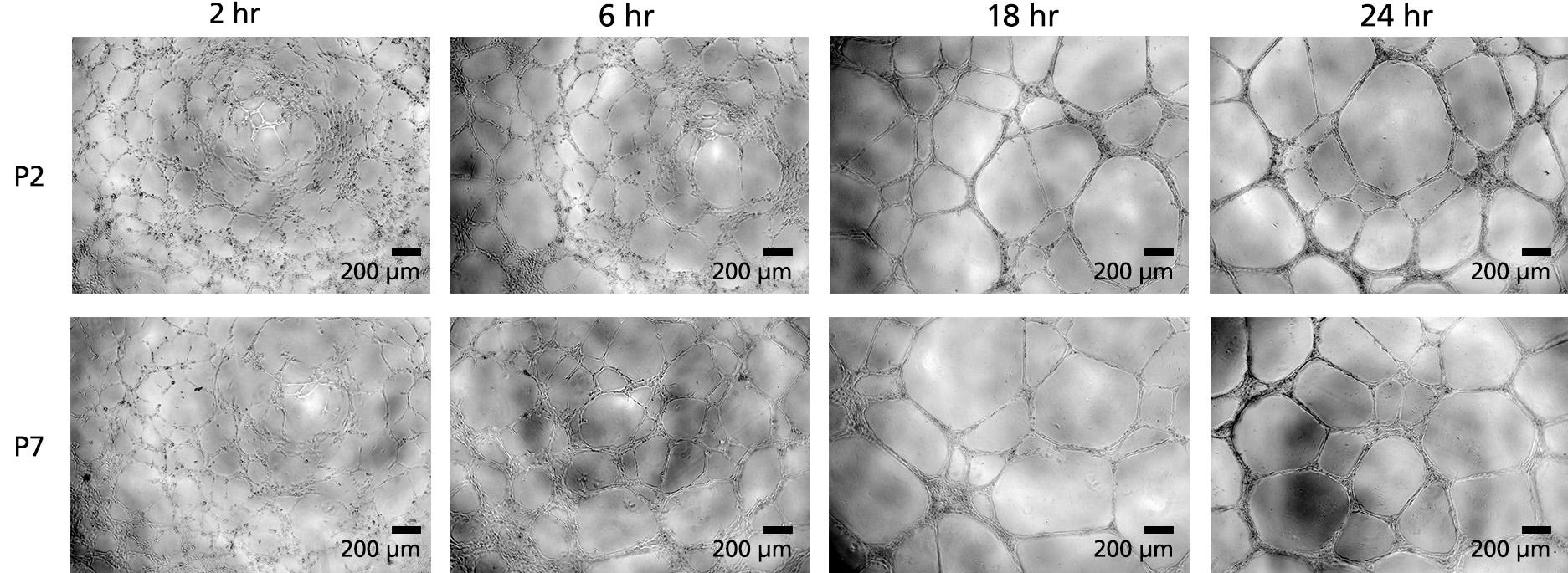 HUVECs, from passages 2 and 7, were plated in EC-Cult™-XF medium and grown for 24 hours. Cells were imaged at 2, 6, 18, and 24 hour time points, showing the ability to form defined tubular branching points as early as after 2 hours of plating.