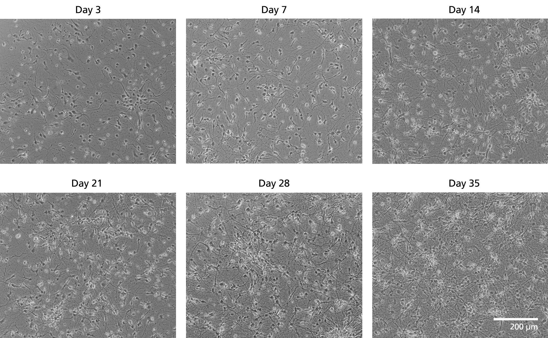 Phase contrast image of Human iPSC-Derived Forebrain Neuron Precursor Cells exhibiting high-quality morphology at various time points.