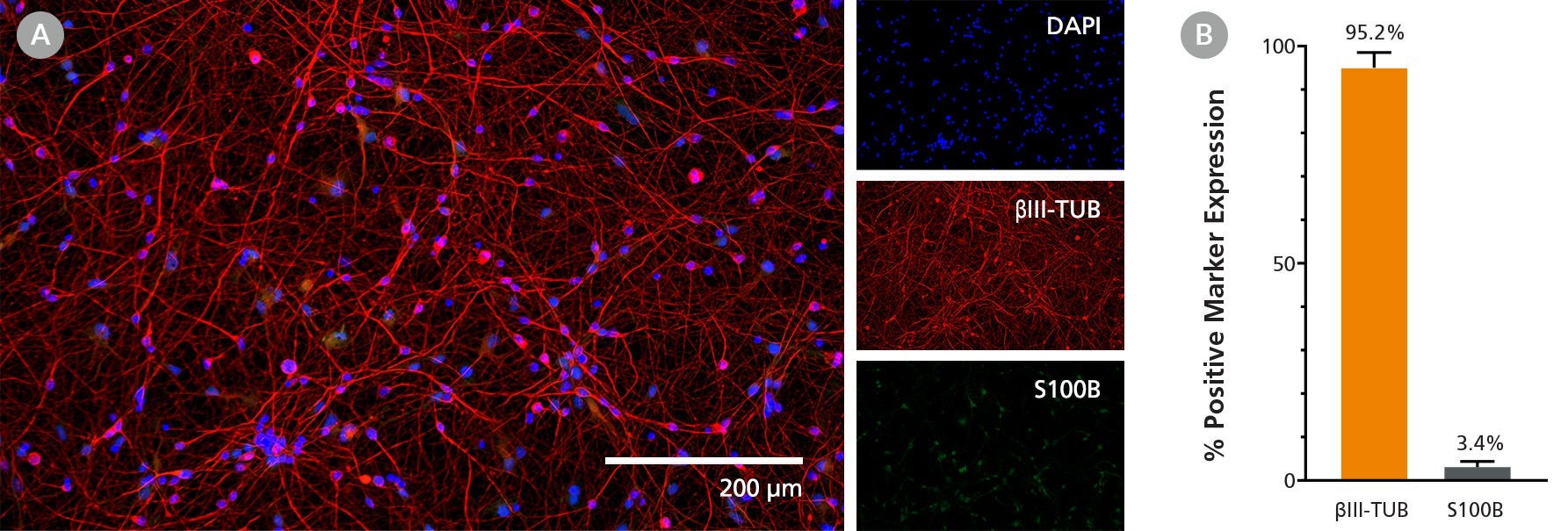 Immunocytochemistry image of Day 19 neurons matured from Human iPSC-Derived Forebrain Neuron Precursor Cells exhibiting a highly pure βIII-TUB-positive neuronal population.