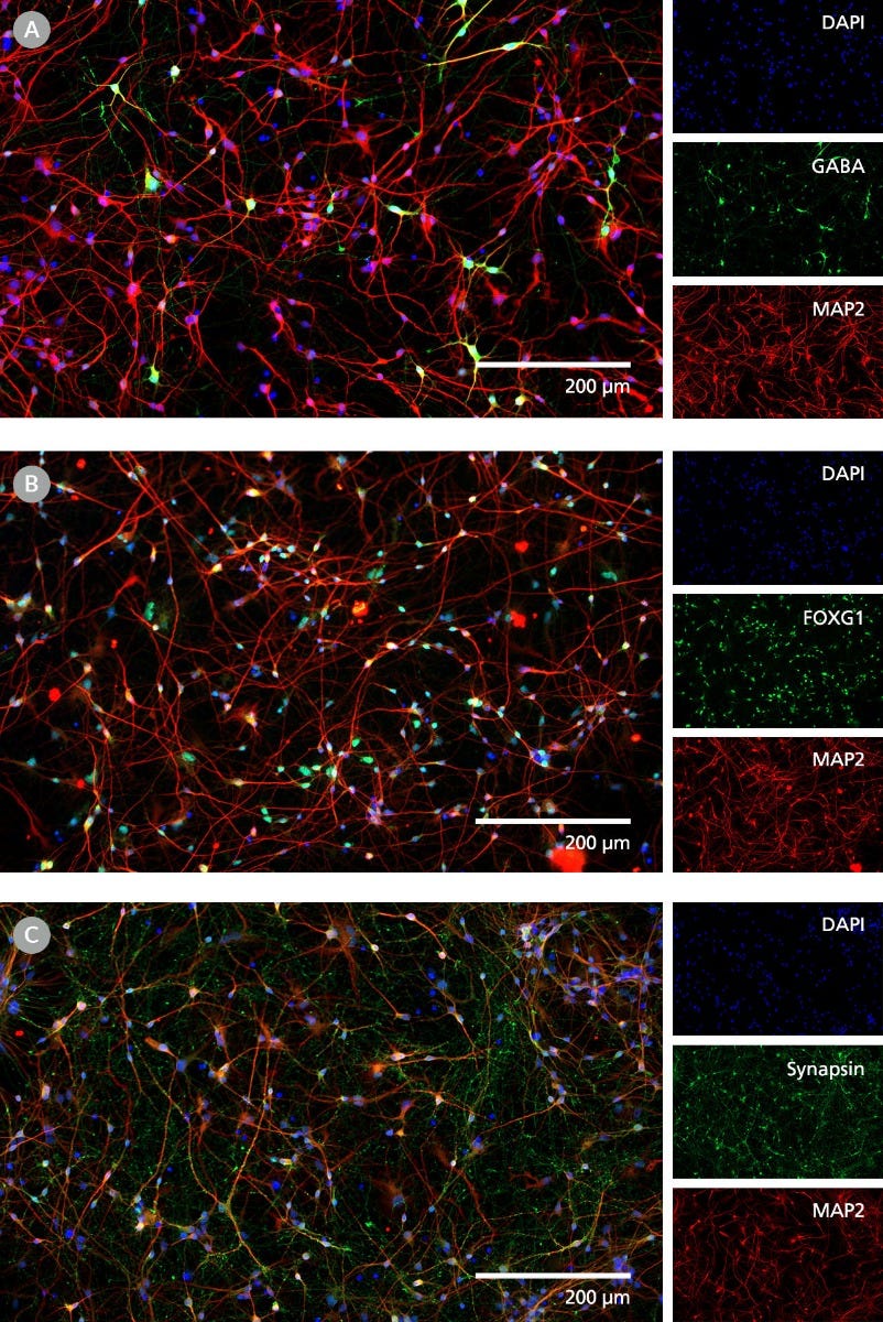 Immunocytochemistry image of Day 24 neurons matured from Human iPSC-Derived Forebrain Neuron Precursor Cells exhibiting MAP2, GABA, FOXG1 and Synapsin markers.