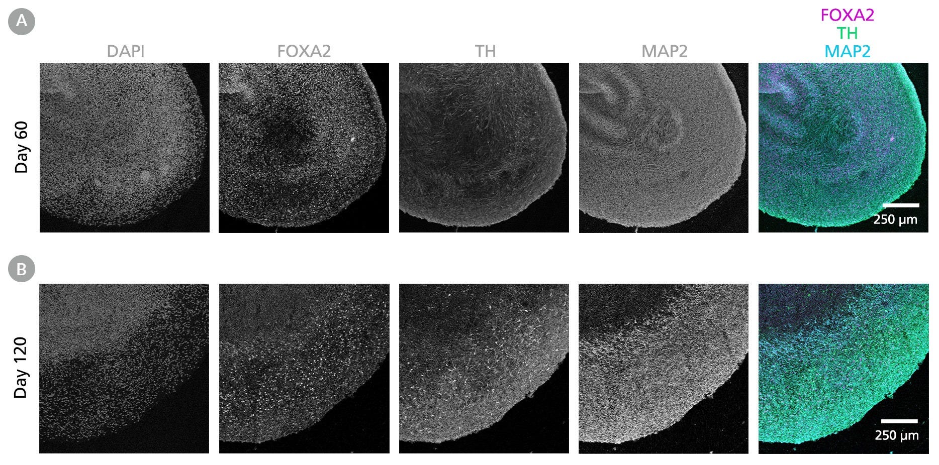 Immunofluorescent images of Human iPSC-Derived Midbrain Organoids exhibiting brain-region-specific marker expression and organization.