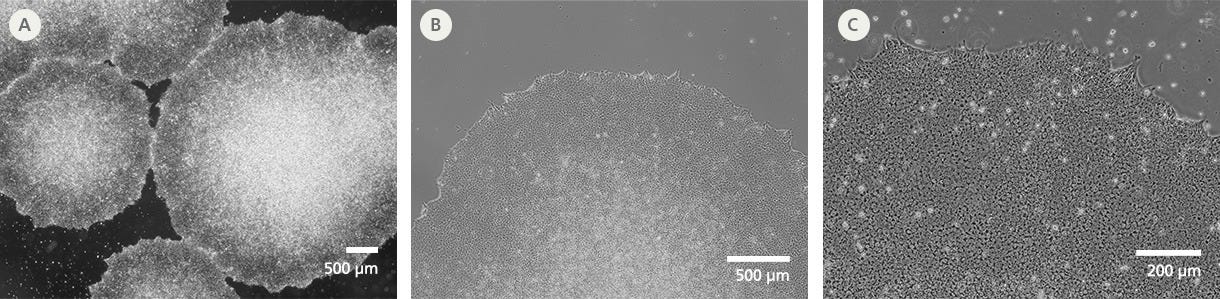 SCTi005-A Human Pluripotent Stem Cells Demonstrate High-Quality Morphology in Routine Culture