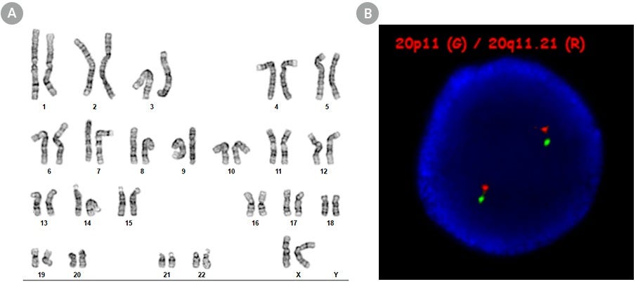 Figure 2. SCTi005-A Human Pluripotent Stem Cells Maintain a Normal Karyotype