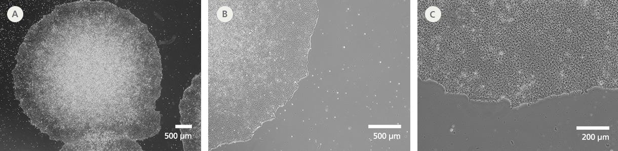 SCTi006-A Human Pluripotent Stem Cells Demonstrate High-Quality Morphology in Routine Culture