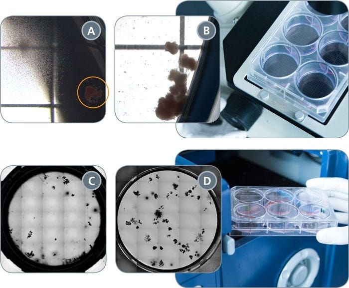 Manual and Automated Counting of Hematopoietic CFU Assays