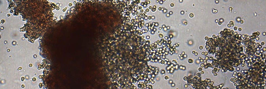 Microscopic view of colony-forming units
