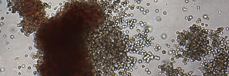 Microscopic view of colony-forming units