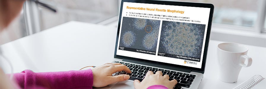 User viewing on-demand neural induction lectures on their personal device.