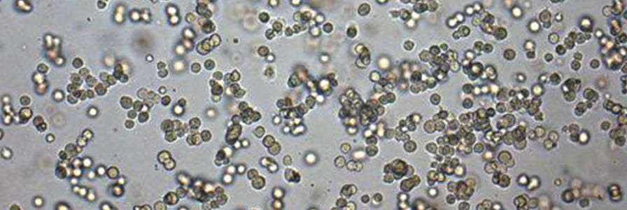 Microscopic view of colony-forming units