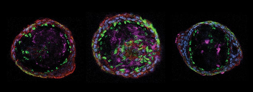 Immunostained airway organoids generated using PneumaCult™ culture media