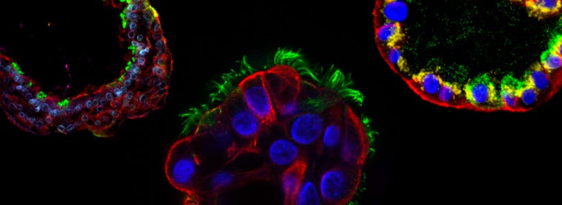 Immunostained airway organoids generated using PneumaCult™ culture media