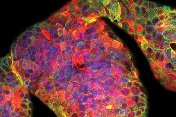Learn how to edit human liver organoids using CRISPR-Cas9 in your lab with the help of this step-by-step protocol.