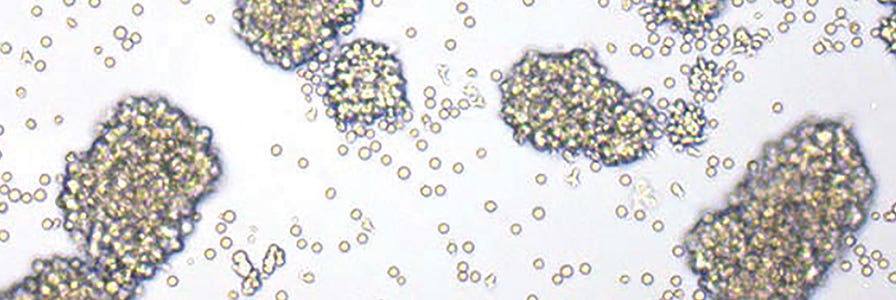 Isolated T cells in culture