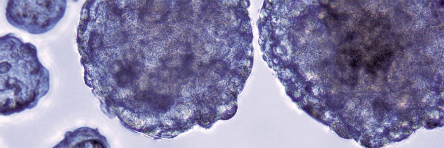 tumor spheroid culture