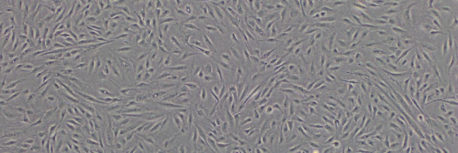 Mesenchymal Stromal Cells