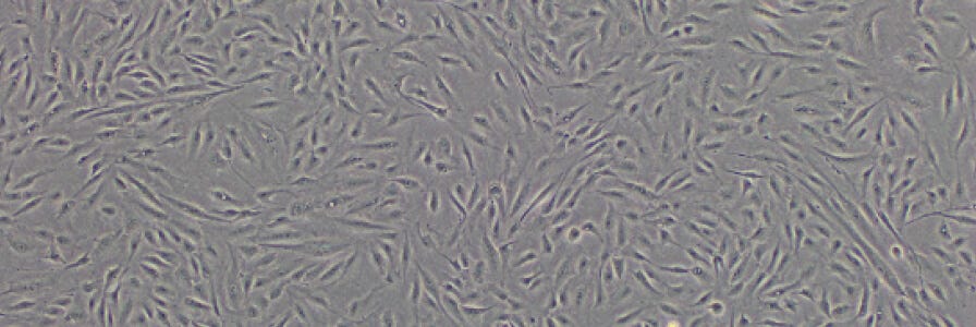 Mesenchymal Stromal Cells