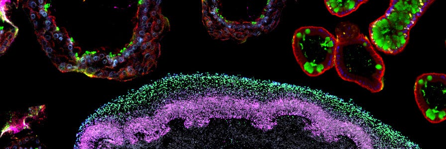 Microscopy image of various organoids