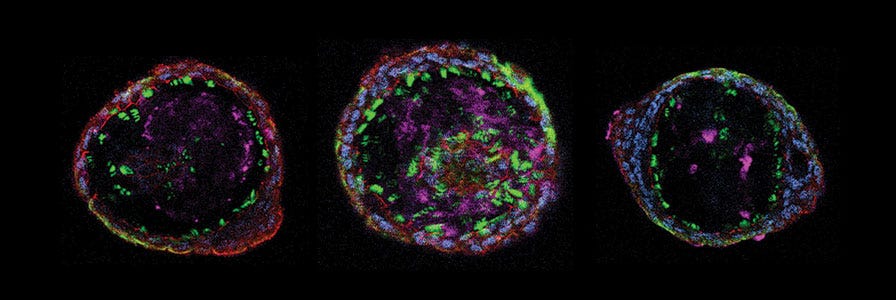 airway organoids