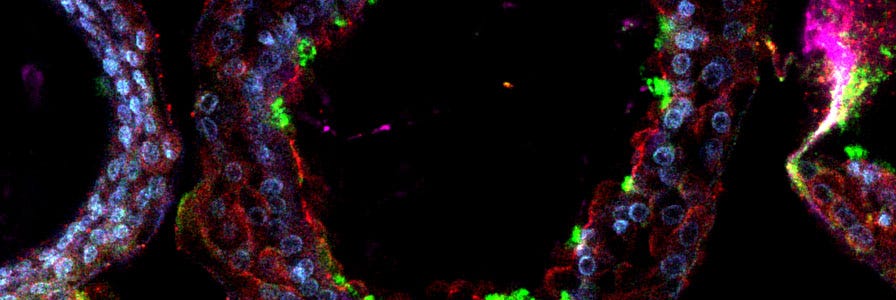 immunostained human airway organoids