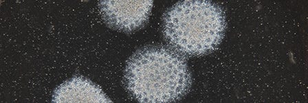 A low objective magnification image of Day 8 neural rosettes to demonstrate the evaluation of neural induction efficiency.