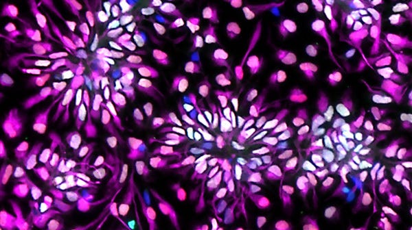 An immunocytochemistry (ICC) image showing expected neural marker expression levels of PAX6, SOX1 & Nestin to characterize neural progenitor cells.
