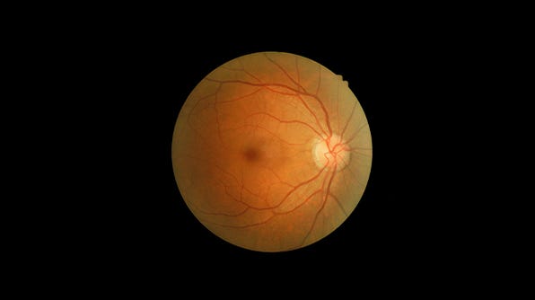 Eye Anatomy