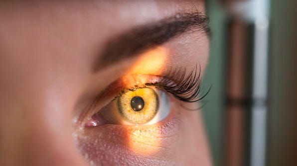 Image of a human eye