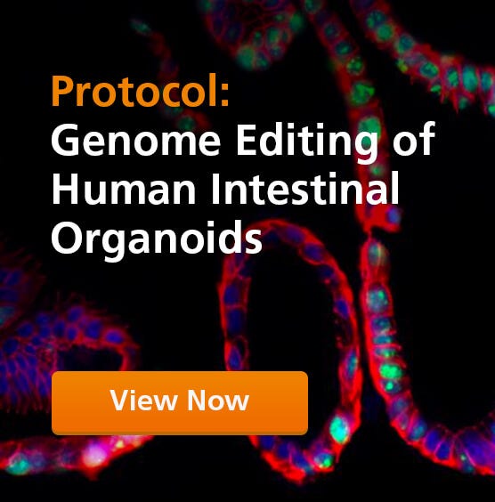 Immunofluorescence image of adult stem cell-derived intestinal organoid.