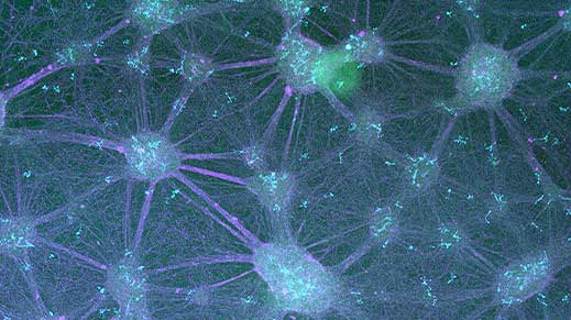 Neuron, astrocyte, microglia tri-culture at Day 30 expressing IBA1 (microglia, cyan), TUJ1 (forebrain neurons, purple), and GFAP (astrocytes, green)