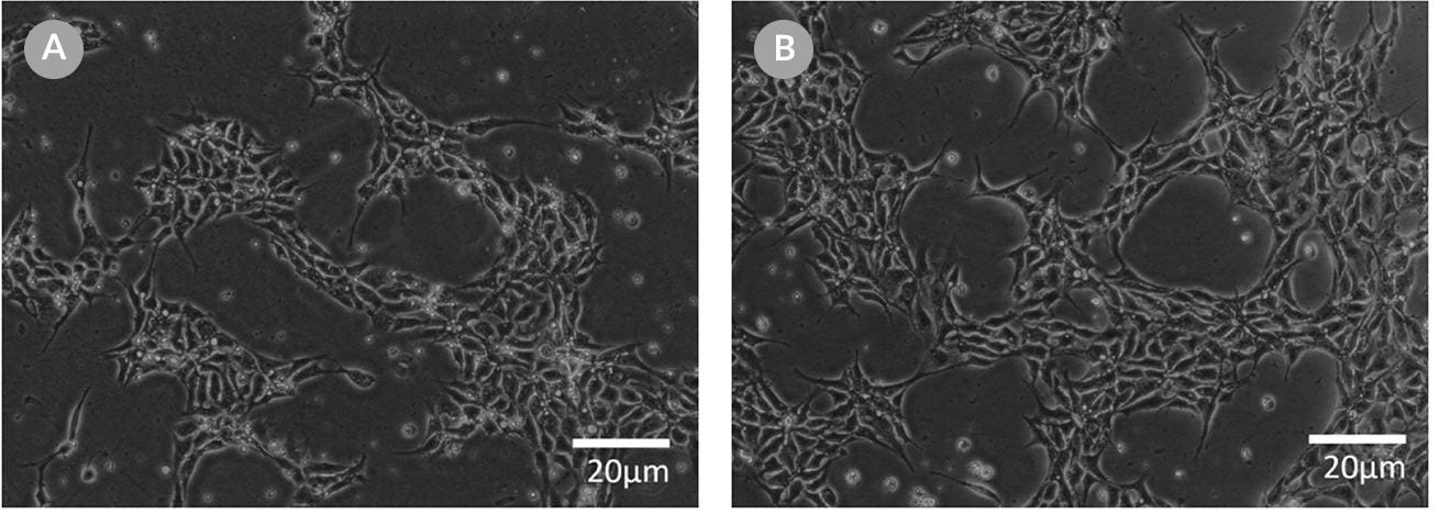 Cell morphology images of ES cells plated in mTeSR™1 and mTeSR™ Plus and supplemented with CloneR™ immediately following RNP electroporation.