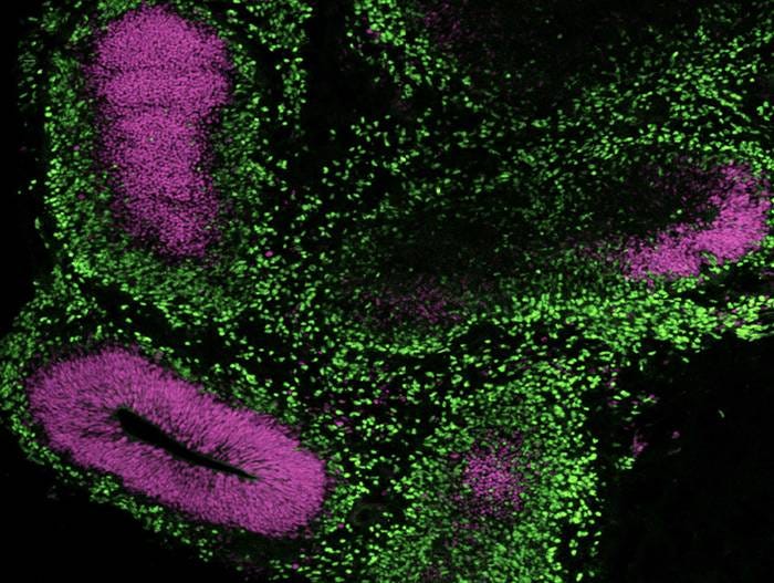 Immunocytochemistry image of a cerebral organoid cultured in mTeSR™ Plus and directed to cerebral organoids using the STEMdiff™ Cerebral Organoid Kit.