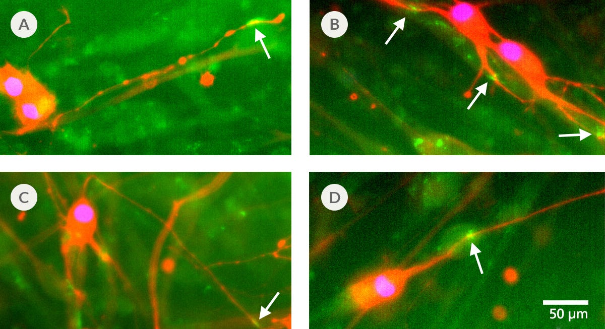 Imaging Showing hPSC-Derived Motor Neurons Co-Cultured with hPSC-Derived Myotubes for In Vitro Modeling