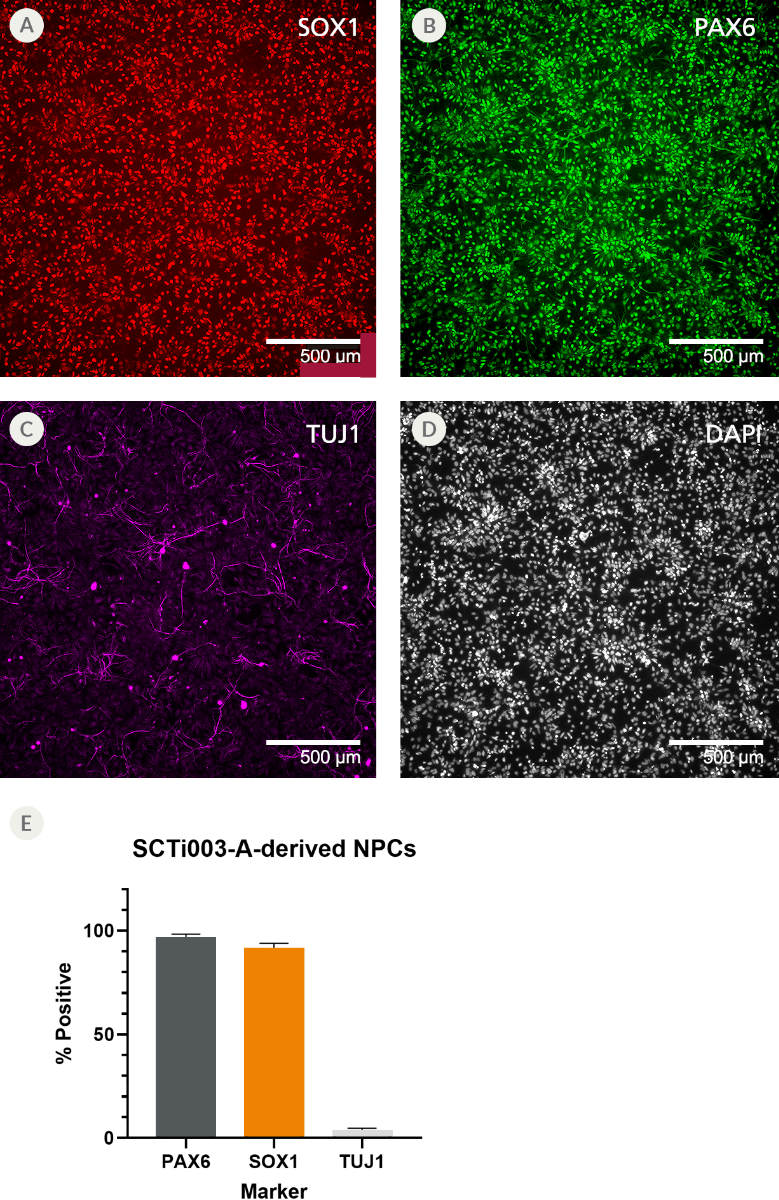 Immunofluorescent images of 2 neural progenitor markers, a mature neuron marker, and a nuclear stain along with their quantification