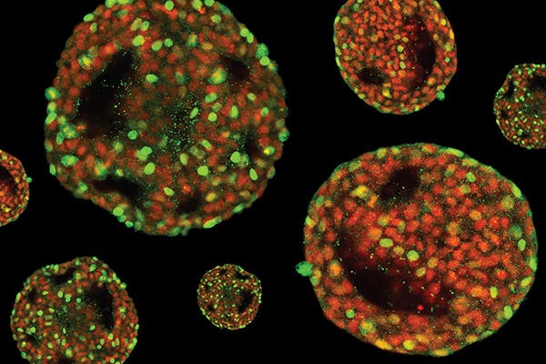 Learn from our in-house PSC experts as they demonstrate how to expand and scale up hPSCs in 3D suspension culture.